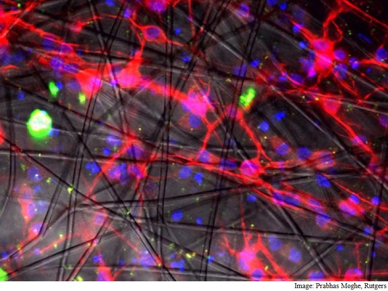 3D Tech to Help Create Human Nerve Cells for Transplants
