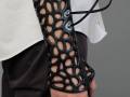 3D-printed plaster cast that reduces healing time by 40 percent osteoid_medical_cast_3d_printed_plaster_adesignaward_small.jpg
