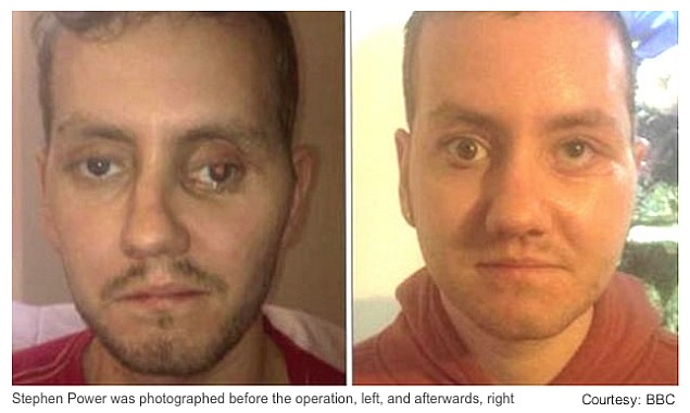 3D printing repairs accident victim's face