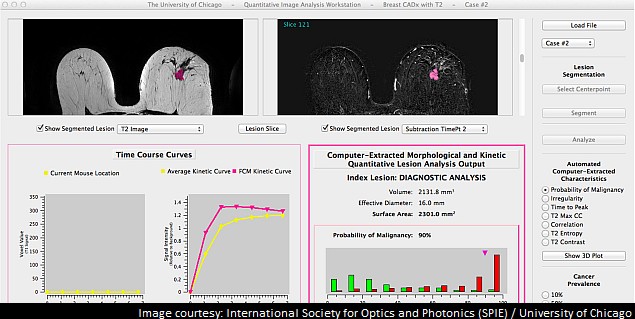 Computer-aided image analysis may help diagnose breast tumours: Study