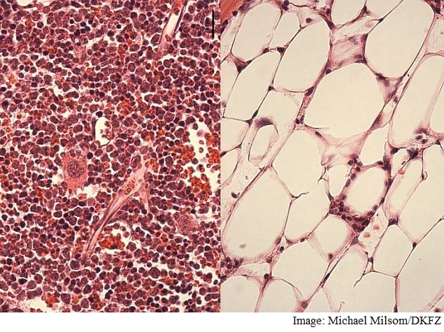 Damaged Stem Cells Linked With Ageing and Cancer: Study