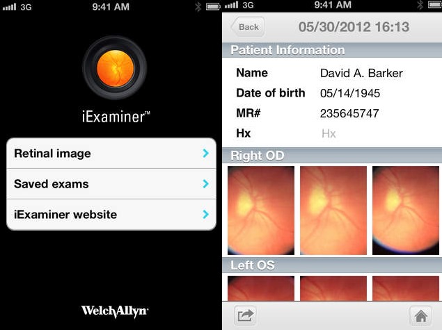 New App to Help Monitor Eye Health