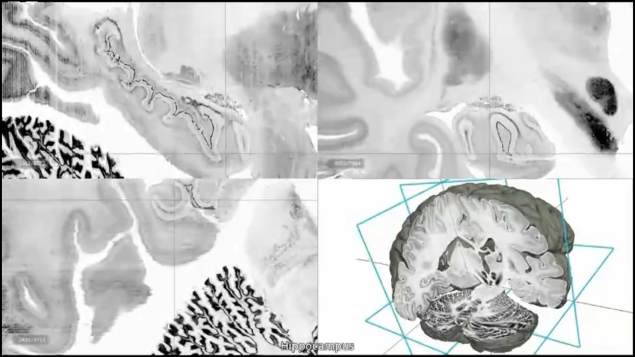 Scientist develop digital 3D atlas of the brain