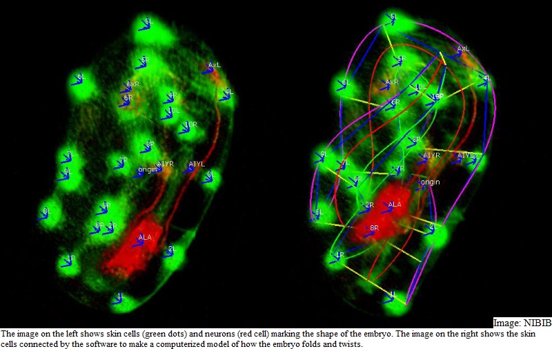 New 3D Software Can Track Embryonic Brain Development