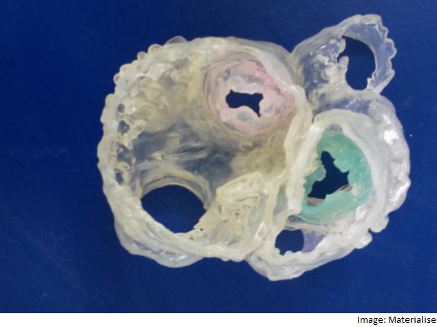 First Heart 3D-Printed With Multiple Imaging Techniques