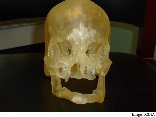 3D Printing to Help Guide Human Face Transplants