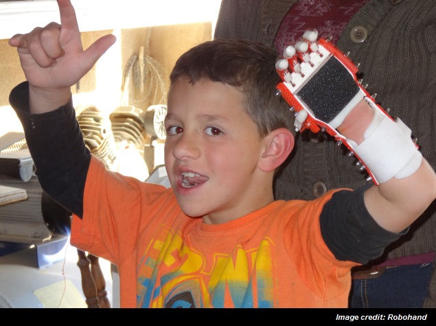 Six-Year-Old Gets 3D-Printed Prosthetic Arm and Hand