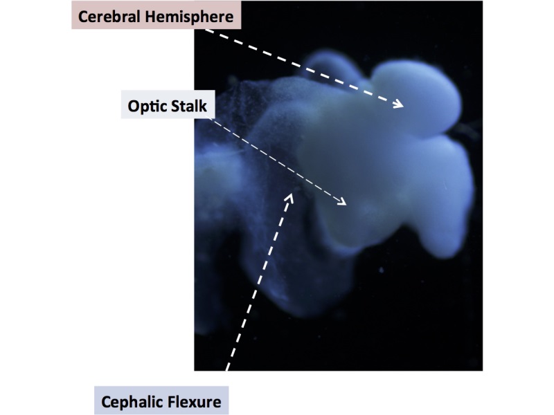 Nearly Complete Brain Grown in US Lab, Says University