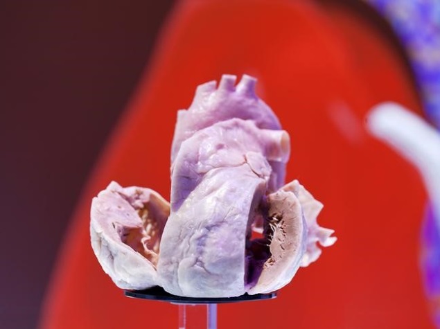 Clockwork Heart Pacemaker Does Away With Batteries