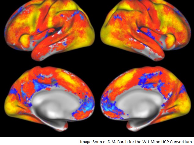 US NIH Presents 10-Year-Plan for BRAIN Project