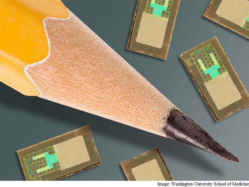 New Brain Implants Can Dissolve When No Longer Required: Study