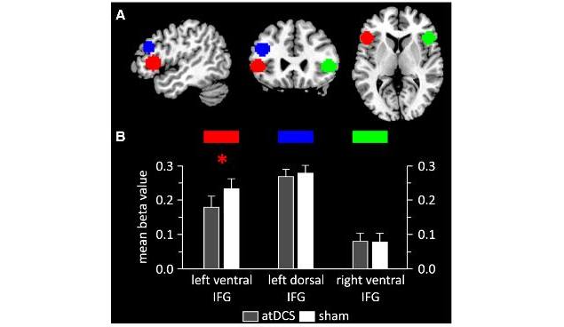 Electric brain stimulation can boost learning speed: Study