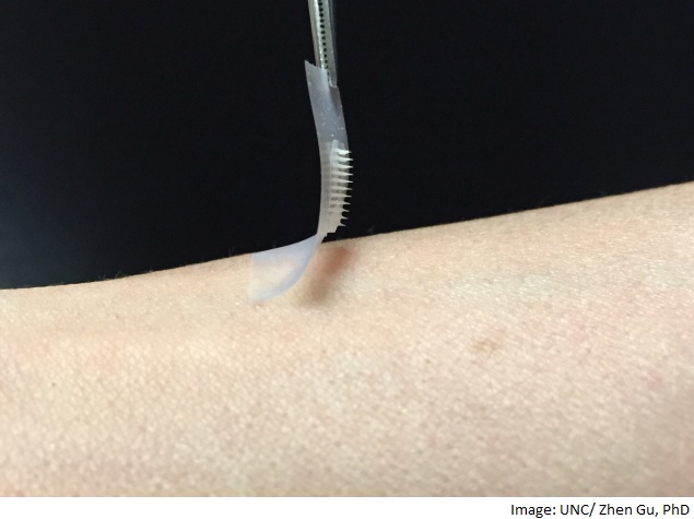 New Insulin 'Smart Patch' Could Help Diabetes Patients