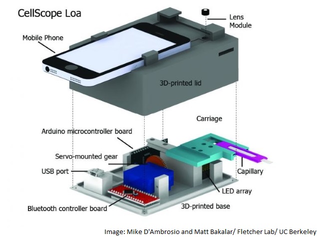 Smartphone Microscope Helps Detect Blood Parasite Levels