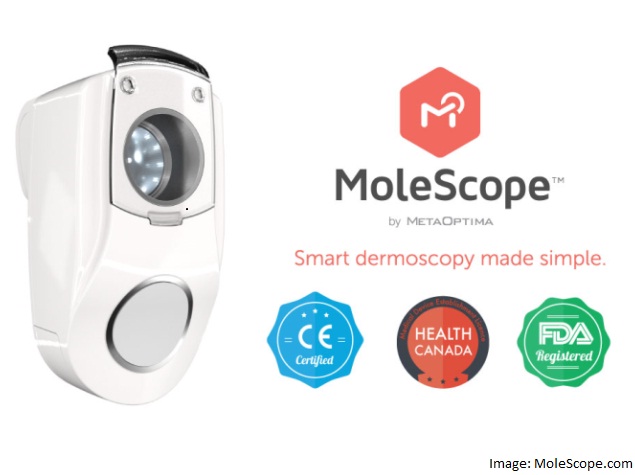 Simple Smartphone Device MoleScope to Help Detect Skin Cancer Early