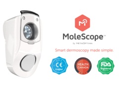 Simple Smartphone Device MoleScope to Help Detect Skin Cancer Early