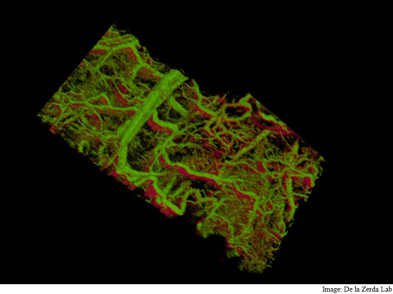 New Technique Developed for 3D Imaging of Cells Under Your Skin
