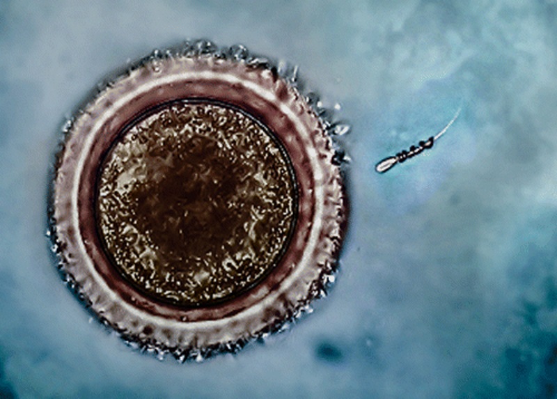 'Spermbots' Could Improve Fertility Treatments: Study