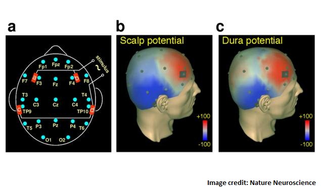 Discovery Allows Scientists to Induce Lucid Dreams in Subjects