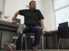 World's First 'Feeling' Leg Prosthesis Offers New Hope to Amputees