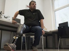 World&#039;s First &#039;Feeling&#039; Leg Prosthesis Offers New Hope to Amputees