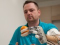 Scientists develop prosthetic hand with sense of touch
