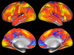 US NIH Presents 10-Year-Plan for BRAIN Project