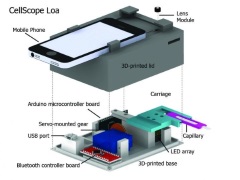 Smartphone Microscope Helps Detect Blood Parasite Levels