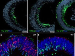 Researchers Create Functional Retinal Tissue With Stem Cells