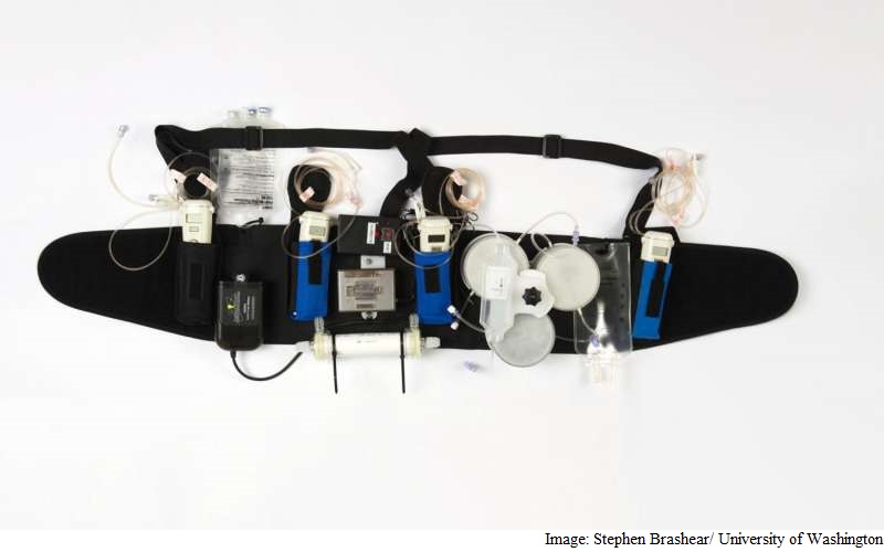 Wearable Artificial Kidney Could Replace Conventional Dialysis