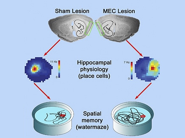 Study Finds What Happens When the Brain's GPS Gets Dismantled