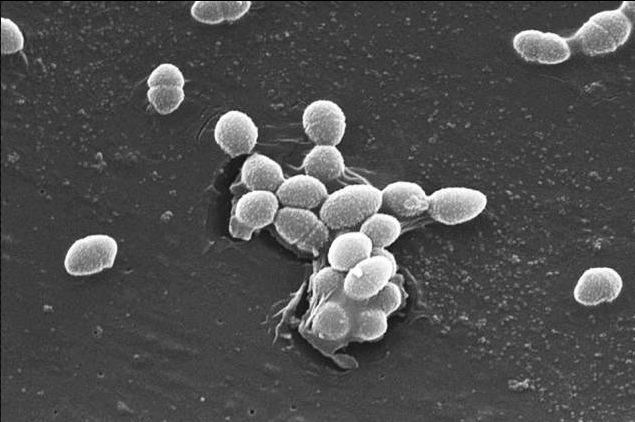 New Bacteria Sensor May Help Prevent Food-Borne Diseases