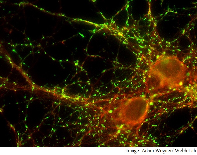 Insight Into How Memories Are Made Could Herald Alzheimer's Treatments